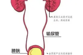 阑尾可“变废为宝”？机器人“巧手”不放支架解决输尿管狭窄图片