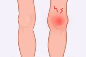 膝盖疼、腿疼、脚疼……5种跑步损伤，专家教你处理！图片