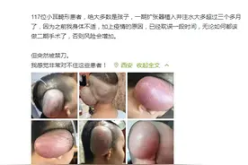 郭树忠教授回应117位患者因停诊无法手术：可继续为患儿进行手术图片