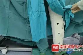 致敬！桂林一医生腿受伤后，戴着支具完成十几台手术图片