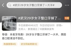 才29岁！女子牙齿掉了一大半，医生一看：剩下的也保不住了图片