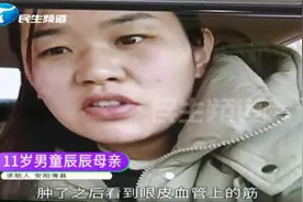 河南11岁男童眼皮莫名“充气”？母亲无奈带其割双眼皮……图片