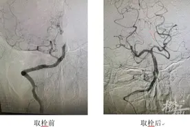 做个“马杀鸡”，39岁男子差点偏瘫！这个地方很脆弱，千万不要随便按图片