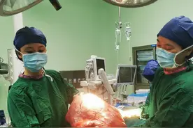 肚子突然膨胀！42岁女子腹大如怀双胞胎 手术取出20多斤重巨型肿瘤图片