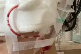 酒店开房当手术室！女生打瘦脸针后毁容：美容师已失联，警方介入调查图片