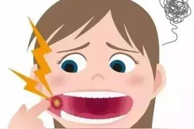 口腔黏膜炎怎么缓解呢？图片