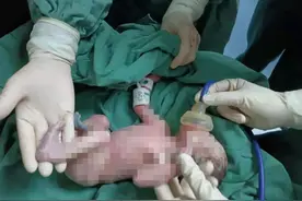 荆门一早产宝宝，刚生下来才2斤！如今成功救治已出院图片