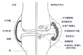 膝关节屈伸不利、摩擦作响……试试这套中医推拿法图片