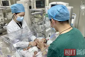 超轻体重双胞胎，出生3个月连闯生死关图片