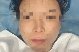 女子在西安高一生医疗美容医院做医美烫伤面部 院方一直提供不了医生资质图片