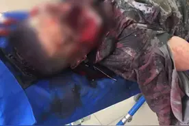 突发！黑龙江一男子疑似被黑熊袭击，命悬一线图片