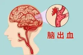 太艰难了，反复腹泻，竟然是艰难梭菌感染？图片