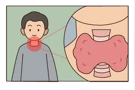 警惕！这5种异常，是甲状腺给你的预警信号！图片