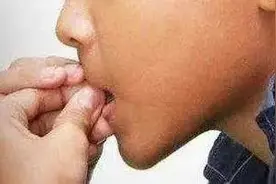 两次手术后，浙江9岁男童仍面临截指！妈妈自责不已，医生：这种习惯重视起来图片