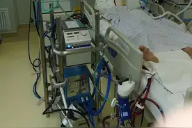 深圳一七旬老人因鹦鹉热致呼吸衰竭，人工肺挽救其生命图片