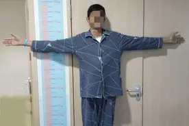 身高1.87米体重50公斤，好身材令人“羡慕”？竟是罕见病导致图片
