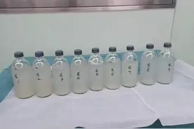 走几步就喘，医生从她肺里洗出24瓶“牛奶”图片