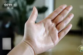 夏季手脚多汗该如何缓解？有妙招→图片