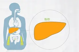 B超查出脂肪肝，怎么办？想甩掉肝脂肪，专家喊你来领食谱啦图片