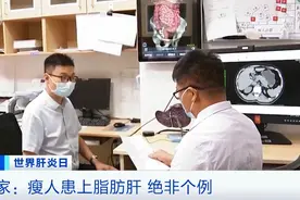 世界肝炎日｜脂肪肝不可忽视！央视关注南城医院肝病防治工作图片