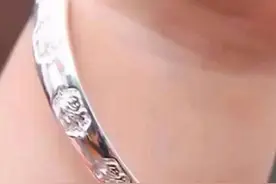 一岁孩子银镯子变色 意外发现汞中毒！当心这些东西是元凶……图片