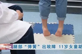 11岁女童踮脚走路像跳芭蕾，医生提醒：可能影响一辈子......图片