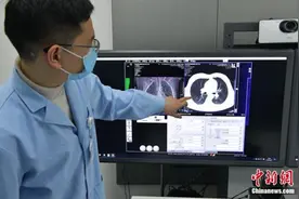 体检高峰期，常规体检到底要不要做胸部CT？图片