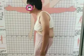 杭州阿姨被“驼背”困扰，连睡觉都成问题，这次她终于能挺起腰板图片
