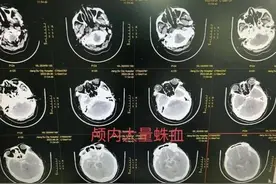 抽旱烟治脸黄，吃活蝌蚪喝蟑螂水，这些离谱的“偏方”……图片