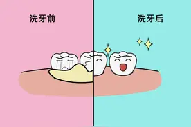 【口腔健康系列科普】老年人口腔保健和义齿护理图片