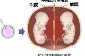 面对这对同卵双胞胎生产难题，“多亏上海专家来了”图片