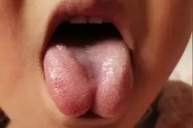 核酸采样时发现部分孩子舌系带过短？医生提醒家长不要忽视图片