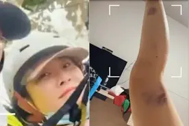 女子玩滑翔伞挂树上，当事人：当时没想到山顶雾那麽大，腿部有大片淤青视频封面