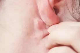 耳朵后面长出来的“小硬包”，到底是什么？图片