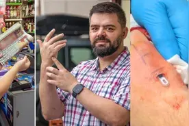 英国男子把银行卡芯片植入手背，称不用再带钱包，网友直呼太离谱图片
