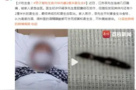少吃生食！男子爱吃生鱼片，体内藏2厘米寄生虫图片
