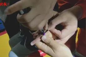 “熊孩子”把铝圈当戒指玩，卡手指上了图片