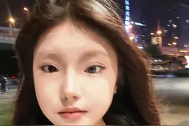 长沙女孩天生异瞳 左眼蓝色走红网络 她坦陈：小时候被叫“蓝眼怪物”有困扰，如今不再自卑图片