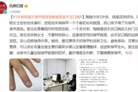 3岁男孩满手指甲脱落，罪魁祸首是手足口病图片