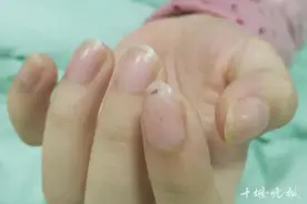 女孩莫名发烧4个月，湖北十堰多专家会诊找到致命“真凶”图片