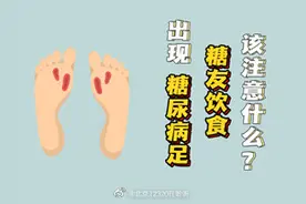 出现了糖尿病足，糖友的饮食该注意什么？图片