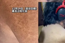 儿子做主播过着黑白颠倒的邋遢生活，父亲辞去万元月薪工作贴身照顾图片