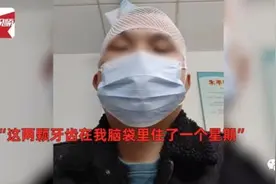 太离谱！“两颗牙齿在我脑袋里住了一个星期”？！图片