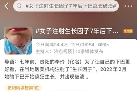 女子注射生长因子7年后下巴疯长！专家：只能外敷严禁注射图片