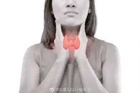 甲状腺疾病的预防图片