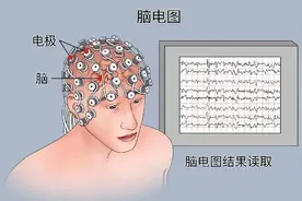 【康复专栏】都知道心电图，今天来认识一下脑电图图片
