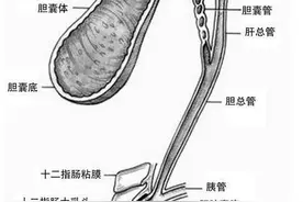 切除胆囊后，可能出现的后遗症有哪些？图片