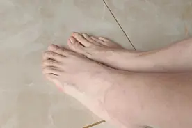 “我们也没想到，43码的脚，竟然是种病”图片