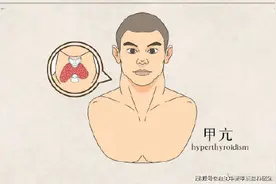 得了甲亢，饮食、生活上有什么禁忌？图片