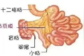 小孩子有一种肚子痛，叫肠系膜淋巴结炎！丨健康科普图片